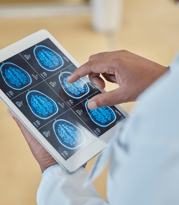 brain scan top rated Open MRI, MRA, and X-Ray service provider in the Tampa Bay area