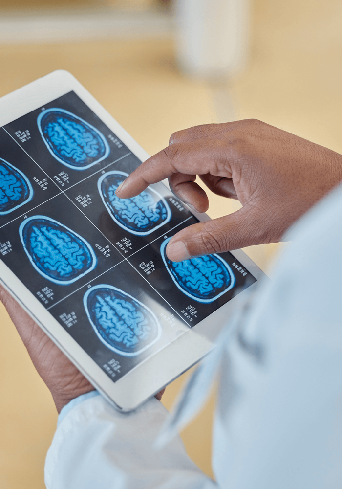 brain scan top rated Open MRI, MRA, and X-Ray service provider in the Tampa Bay area